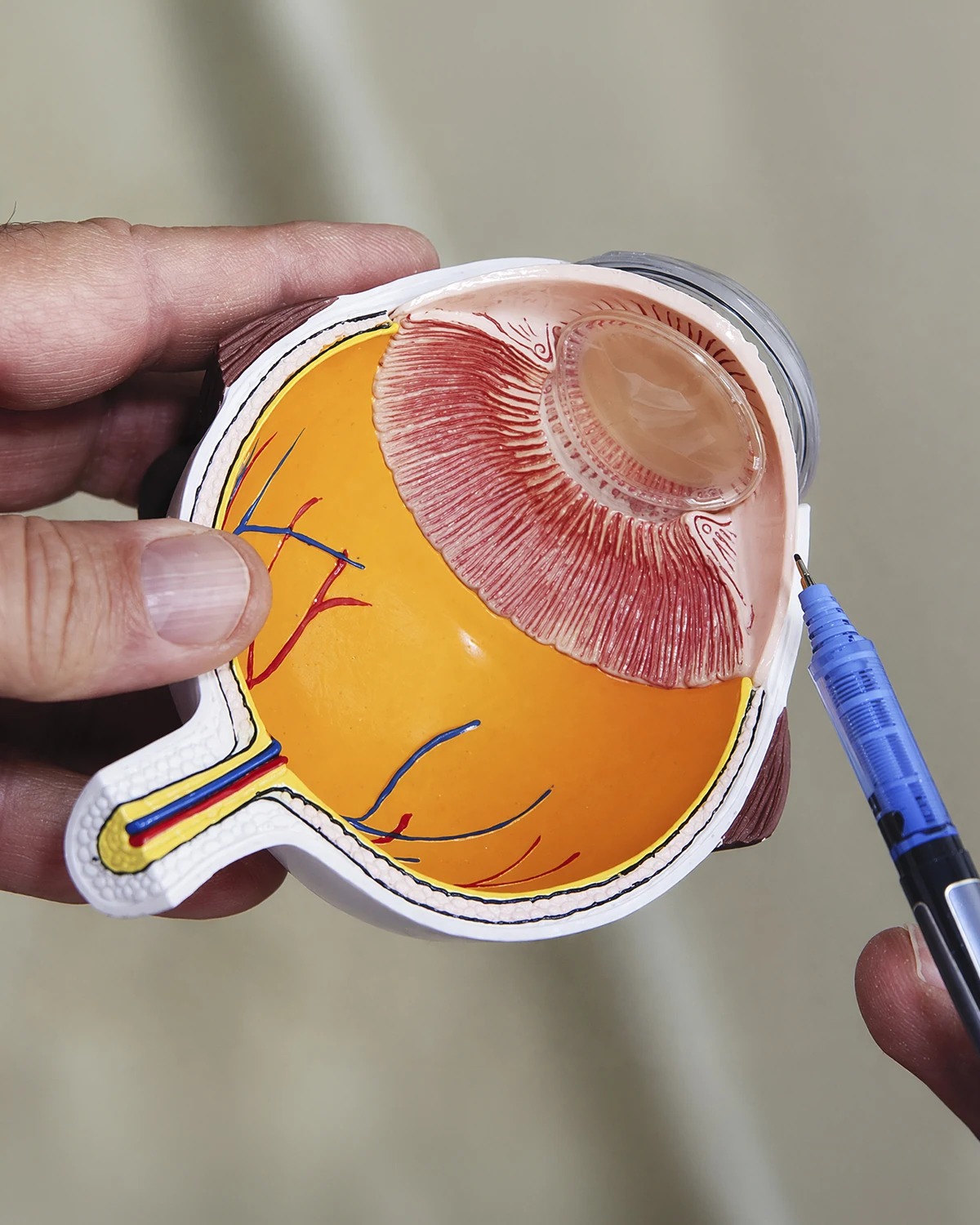 Cornea and keratoconus treatment at Centro Láser, Santo Domingo
